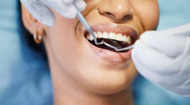 Best Emergency Dentist for Special Needs Patients in Sandoval, IL