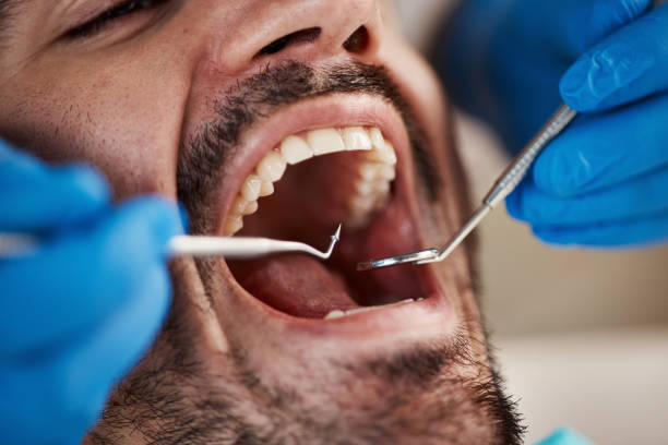 Best 24-Hour Emergency Dentist in Sandoval, IL